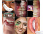 do a professional video editing on your dental cases
