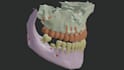 create a 3d biomodel printable  for surgical plans