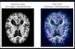train and finetune deep learning models and apply xai