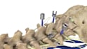 create scientifically accurate 3d medical animation, surgery video