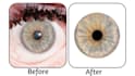 professional eye iris sharpening enhancement