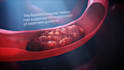 create 3d medical animation, medical explainer, surgery