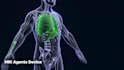 3d anatomy and surgery animation medical explainer video with visualization