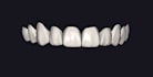 design 3d printed and milled veneers