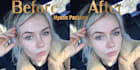 remove unwanted blemishes and perfect facial imperfections
