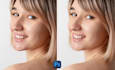 retouch your skin, remove your pimples, acne retouching