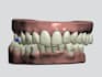 do dental clear aligner treatment planning on archformh and 3shape