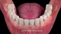 do 3d dental animation, 3d medical animation, surgery animation and 3d animation