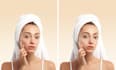 retouch your skin, remove your pimples and acne in photoshop