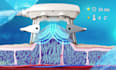 medical animation, 3d medical device explainer, surgery animation, anatomy video