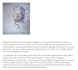 write soap notes and physiotherapy documentation