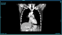 develop dicom viewer or customize ohif