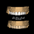 exocad design esthetic veneers, crowns, implants