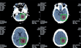do medical imaging processing with ml, dl, computer vision