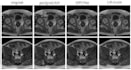 do medical imaging processing with ml, dl, computer vision