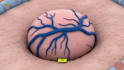 create 3d medical animation medical explainer video medical procedures animation