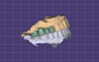 design professional dental cad designs using exocad
