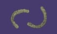 design a full mouth hybrid prothesis on exocad