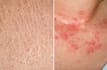 skincare second opinion by MD