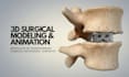 enhance patient education with 3d medical animations