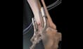 create 3d medical animation, anatomy, surgery animation, 3d explainer video