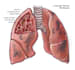 design and illustrate a medical illustration