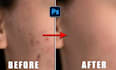 remove anywrinkles, blemishes, spots, pimples