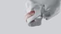 do 3d dental animation, 3d implant animation, 3d surgery animation, 3d medical