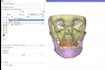 segment anatomical structures from nifti dicom images using 3d slicer