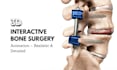 create precise orthopedic 3d medical animations
