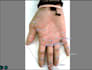 do keypoint and segmentation masks annotation