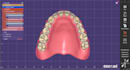 design premium complete denture your patient deserve