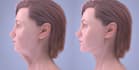 create realistic and cgi 3d medical animation for surgery procedures