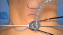 3d medical animation, anatomy explainer, surgery procedure animation, 3d surgeon