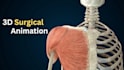 create professional 3d medical animation