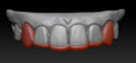 design grillz or any teeth jewelry