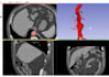 create 3d printable models from ct or mri dicom files