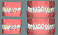 do clear aligners treatment planning on onyxceph, softsmile