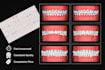 do predictable clear aligners treatment planning