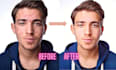 retouch your skin ,remove your pimples and acne