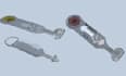 medical 3d product design,prototype model,prosthetics,implants,devices,step,stl