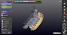 create accurate dental prosthesis designs using exocad