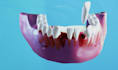 oral cgi 3d cgi medical animation 3d explainer video  high quality dental medica
