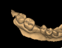 design crown and bridge using exocad