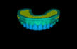 design dental waxup dsd using exocad
