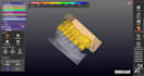 create  designs digital complete denture using exocad