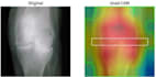 do medical imaging ai for disease classification by grad cam mri xray radiology