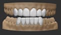 3d cad grillz as diverse and as quickly as possible