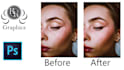 professionally remove acne and pimples from your photos