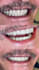 create a professional dental motion graphic